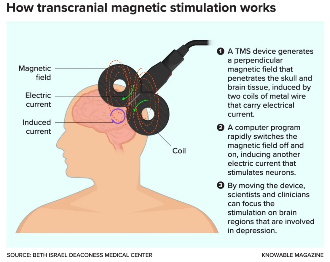 A magnetic therapy for depression gains precision.jpg