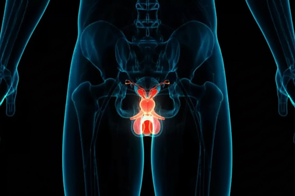 Blocking newly discovered enzymes could boost prostate cancer treatment.jpg