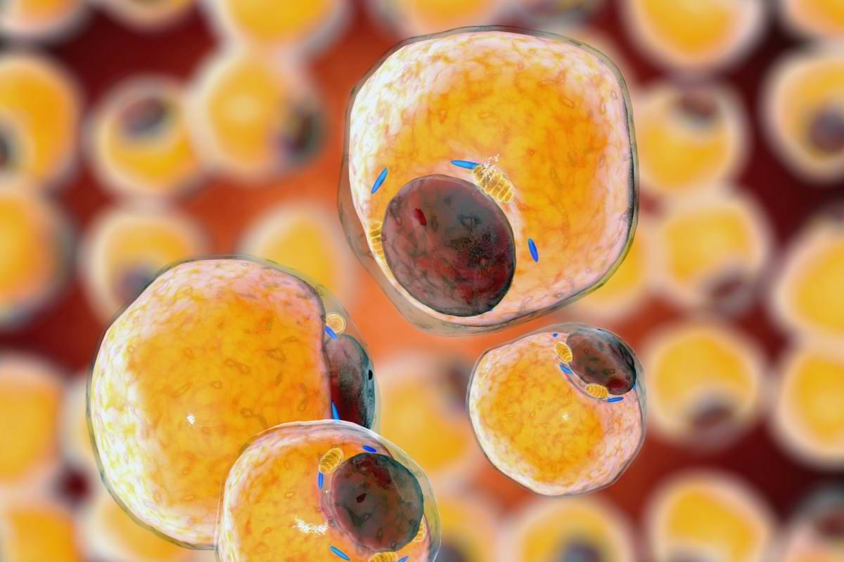 Brown fat repressor protein targets cancerrelated weight loss.jpg