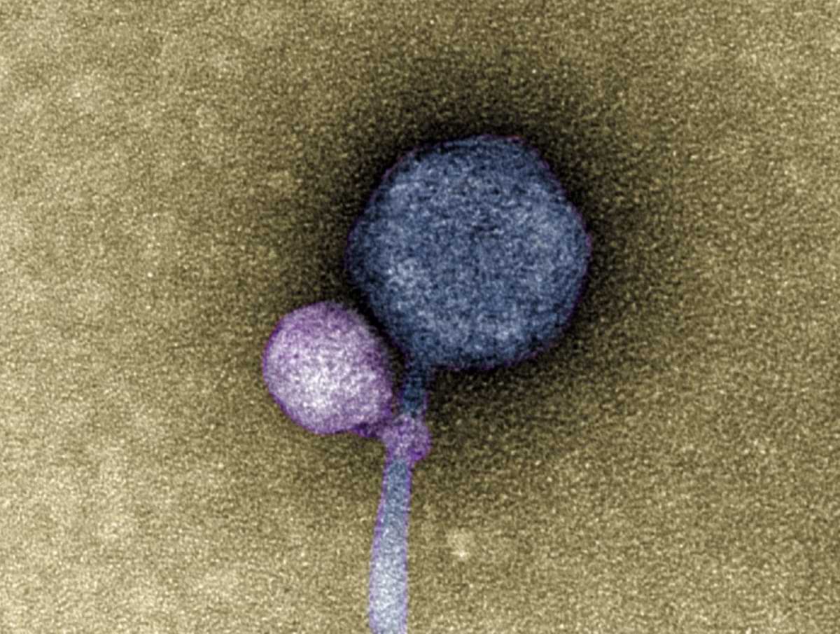 Observation Of A Virus Attaching To Another Virus.jpg