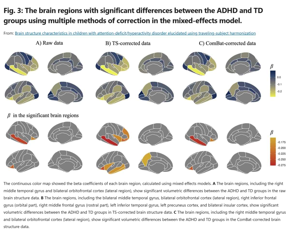 The brain regions with significant differences between the ADHD and TD groups.jpg