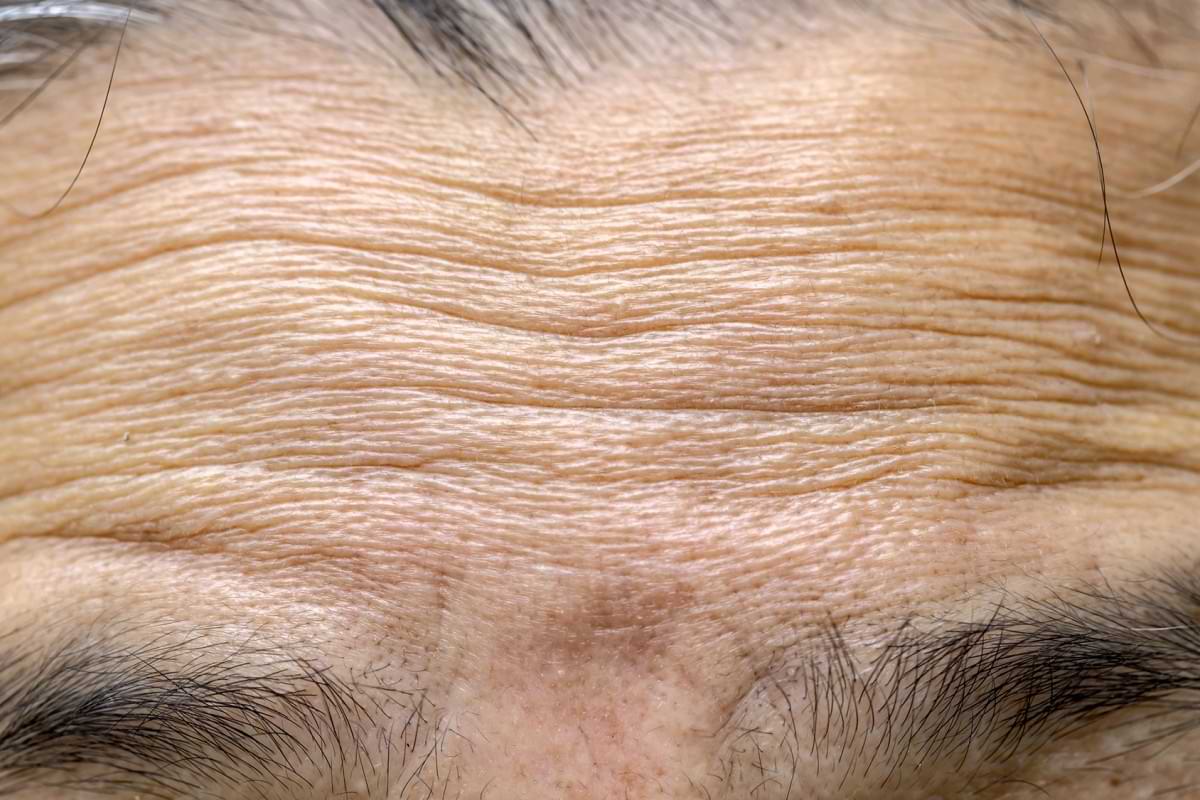 The mechanics of why we wrinkle as we age have been revealed.jpg