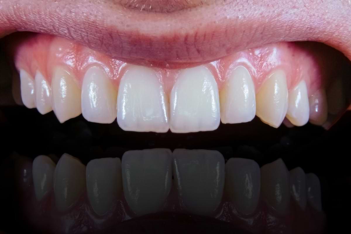 Want healthier gums Eating this way could help says new study.jpg