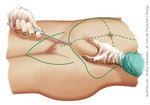 plastische_chirurgie5.jpg