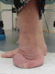 17a.gif
