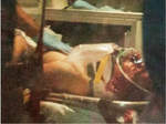 Dzhokhar-Tsarnaev-face.png