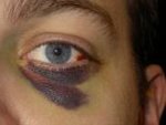 38819787blauesauge041sa6.jpg