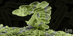 multiresistente-keime-bakterien.jpg
