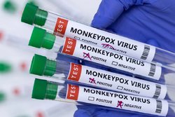 monkeypox-test.jpg