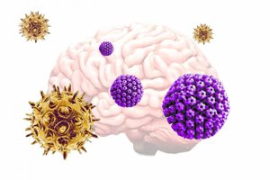 Pair of common viruses may trigger Alzheimers disease.png