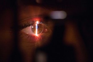 Eye surgeons turn to teeth in astonishing vision treatments.jpg