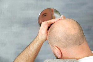 Stopping hair loss may be as easy as boosting this bodyguard protein.jpg