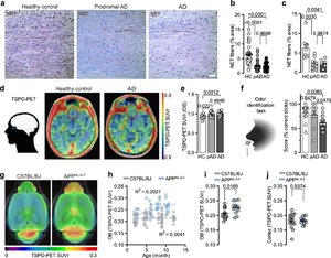 TSPO-PET signals in mice and humans and LC axon loss in the OB of humans indicate hyposmia.jpg