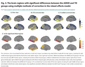 The brain regions with significant differences between the ADHD and TD groups.jpg