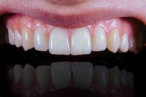 Want healthier gums Eating this way could help says new study.jpg