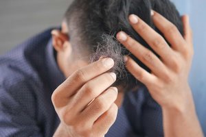 Natural sweetener found to turbocharge baldness treatment.jpg