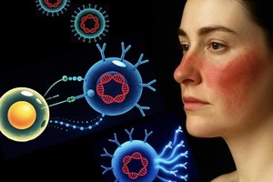 We now know what causes lupus the EpsteinBarr virus 95 of us live with.png